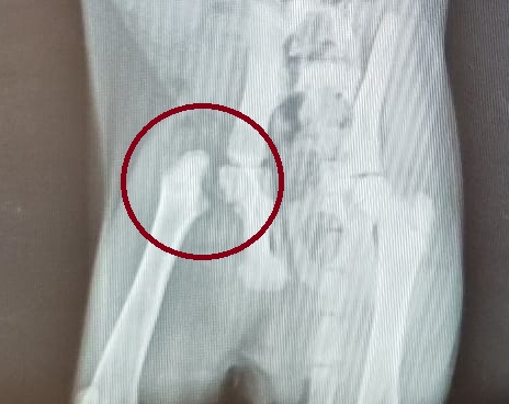 Röntgenfoto van Koentje met de afgebroken heupkop aangeduid in een rode cirkel